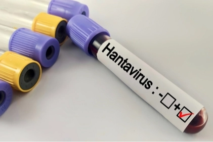 Hantavirüs salgına dönüşür mü? Kapalı alan temizliğinde büyük risk